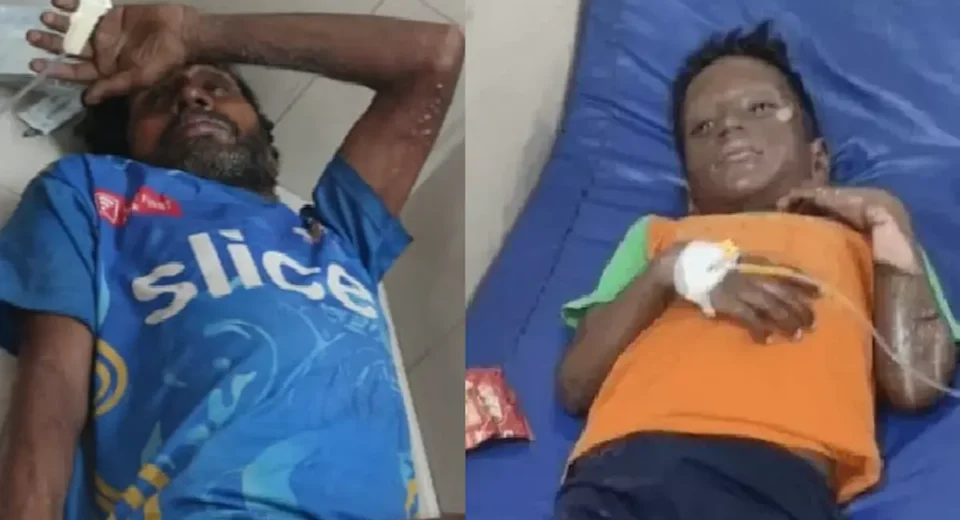 मुंडन कार्यक्रम में फटा सिलेंडर, 2 बच्चों समेत 9 लोग बुरी तरह झुलसे मुंडन कार्यक्रम में फटा सिलेंडर, 2 बच्चों समेत 9 लोग बुरी तरह झुलसे