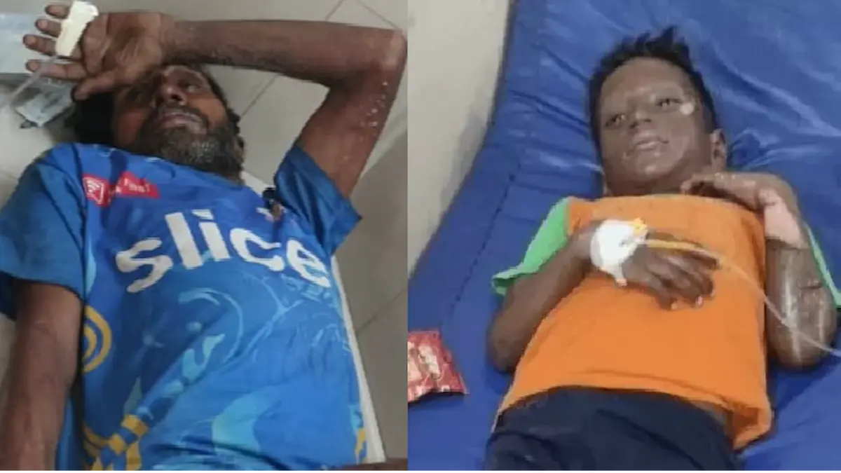 मुंडन कार्यक्रम में फटा सिलेंडर, 2 बच्चों समेत 9 लोग बुरी तरह झुलसे