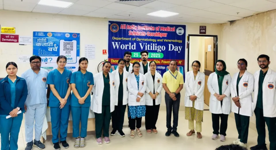 एम्स गोरखपुर में 'वर्ल्ड विटिलिगो डे': एआई से इलाज और मिथकों पर चर्चा, जानें क्या है श्वेत कुष्ठ की सच्चाई